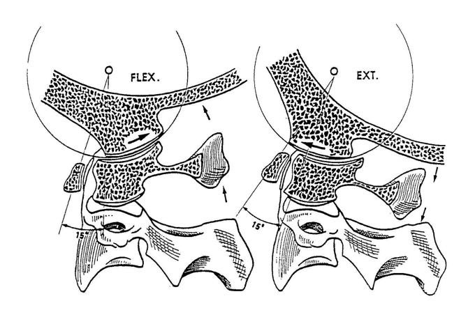 To stretch the right posterior capsule, stand on the right of the patient. Fix the mandible with your right hand, while the left hand supports the occiput. Retract into upper cervical flexion, and add rotation using both hands. The goal is pain provocation.