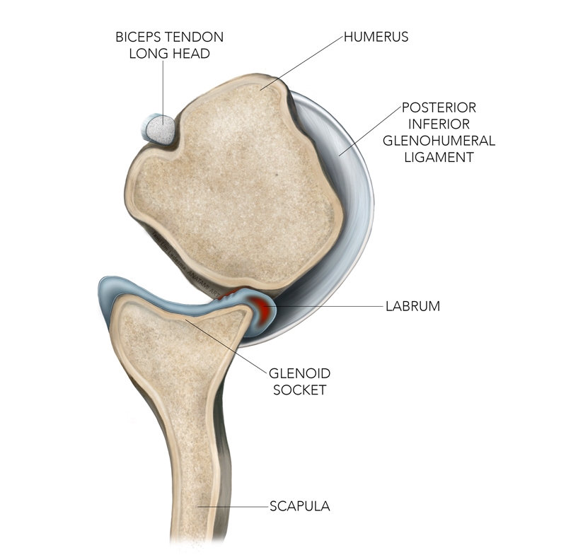 Sports Injury Bulletin Diagnose Treat Uncommon Injuries Kim Lesions