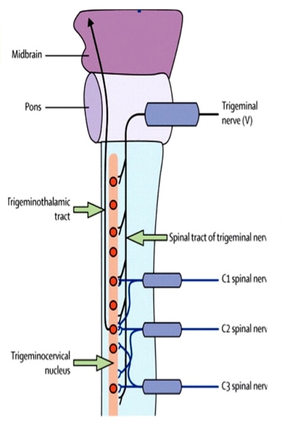 Figure 2: Mechanism of pain referral from the cervical spine to the head